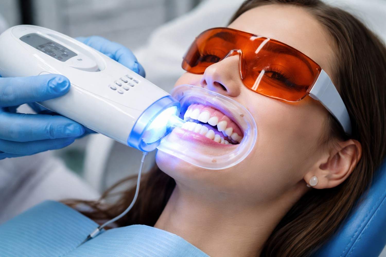 Direct Whitening Session