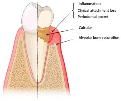 CBC Periodontal Treatment Benefits