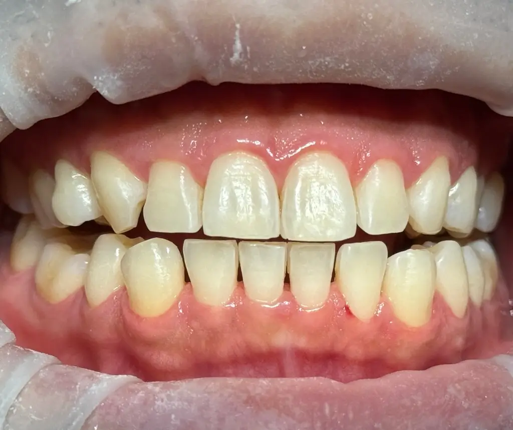 Before Biofilm Disclosing