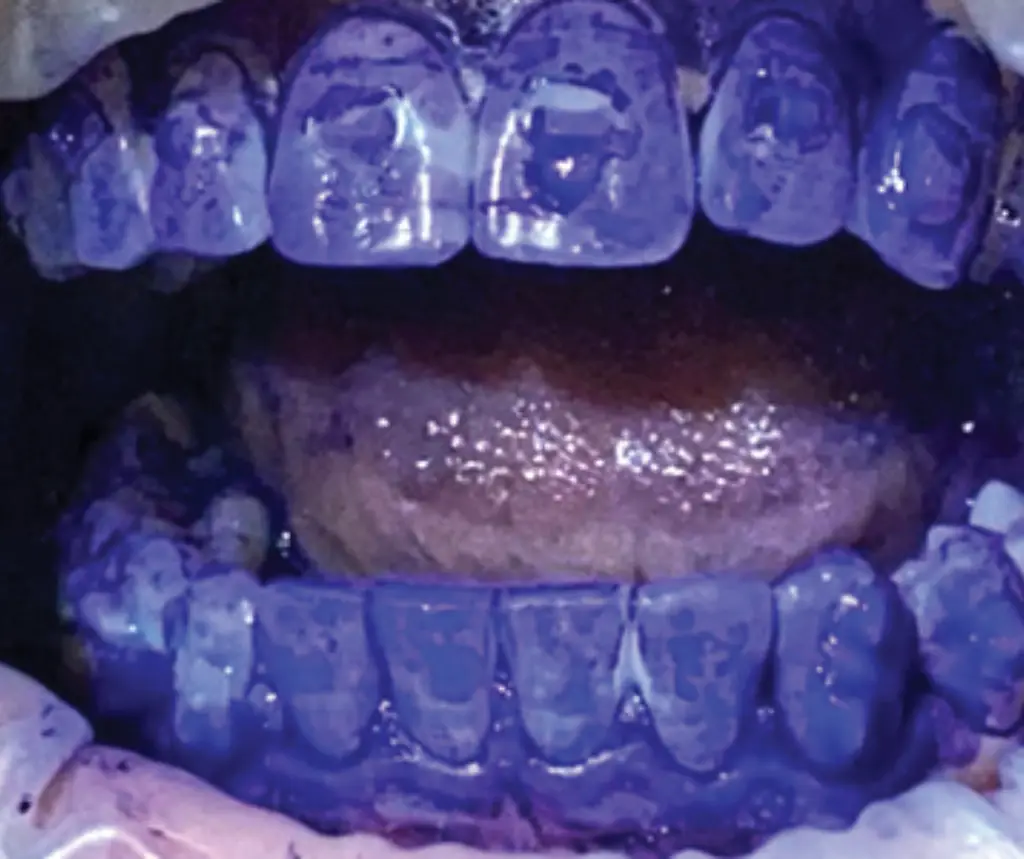 Apply Biofilm Discloser
