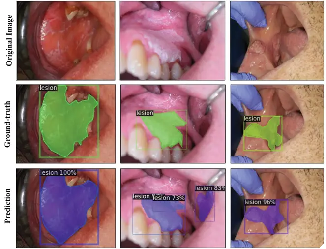 Tissue AI - Oral Condition Detection